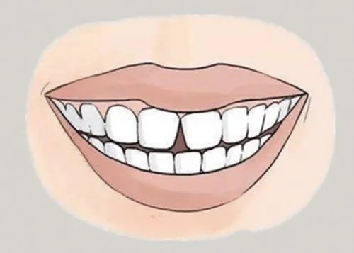 <a href=http://www.nj-zz.cn/news_article?news_id=116>一次性口腔探針</a>